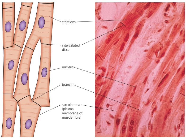 Diagram and micrograph of branched, striated cardiac muscle cells showing nuclei, sarcolemma and intercalated discs.
