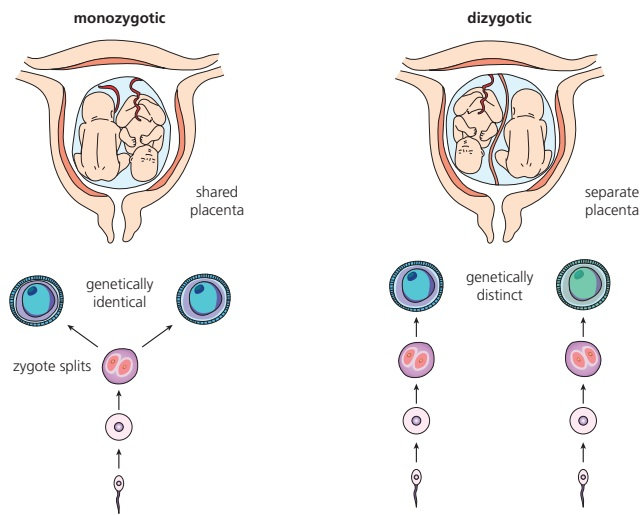 Monozygotic twins arise when one zygote splits, whereas dizygotic twins arise from two separate eggs and sperm and are genetically distinct.