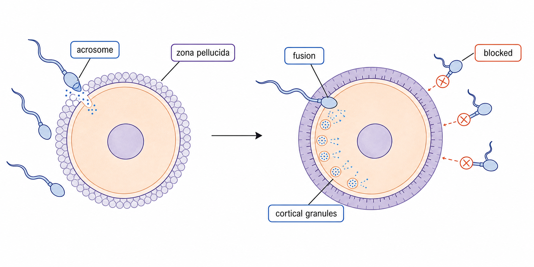 A sperm acrosome releases enzymes to cross the zona pellucida, then sperm–oocyte fusion triggers cortical granule release that blocks other sperm.