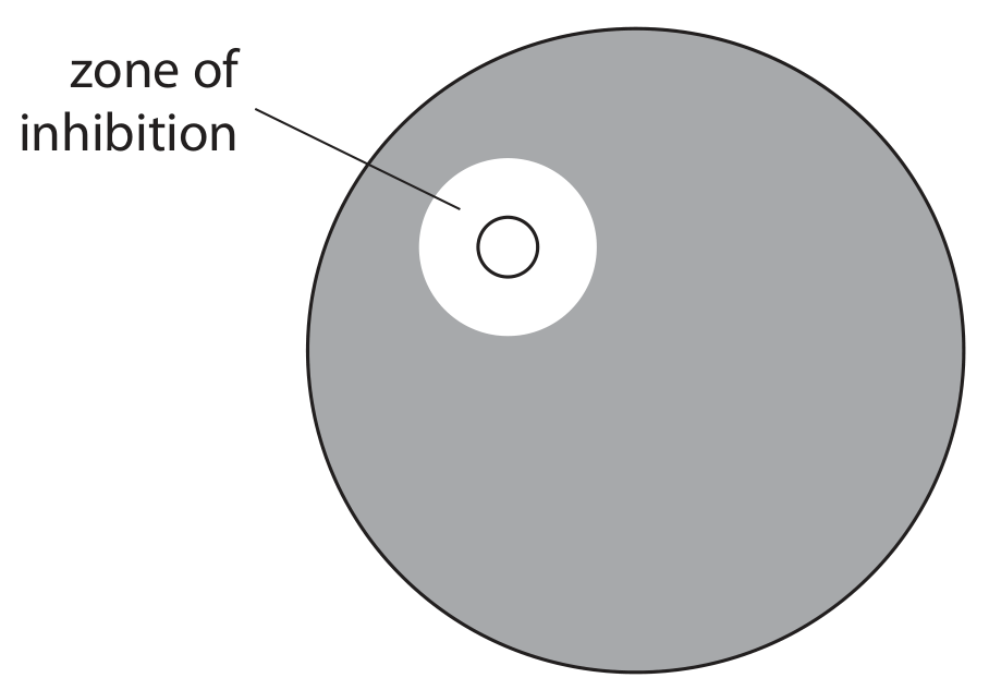 Figure for Question 5(c)(ii) — Edexcel A-Level Biology A2