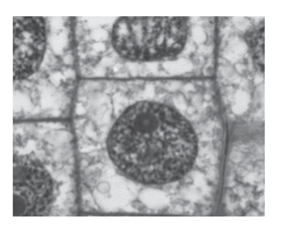 © J. L. Carson, Ph.D./SCIENCE PHOTO LIBRARY