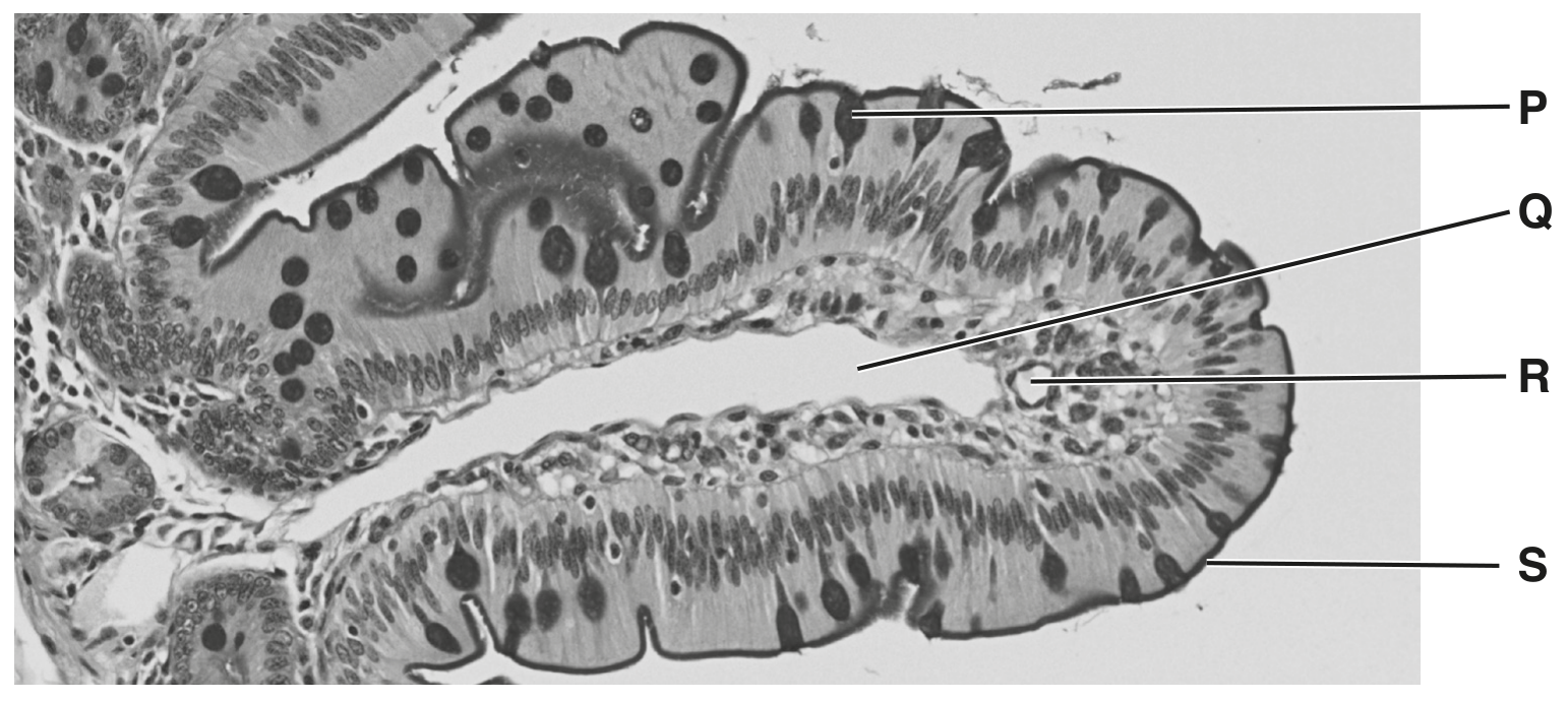 Fig. 1.2