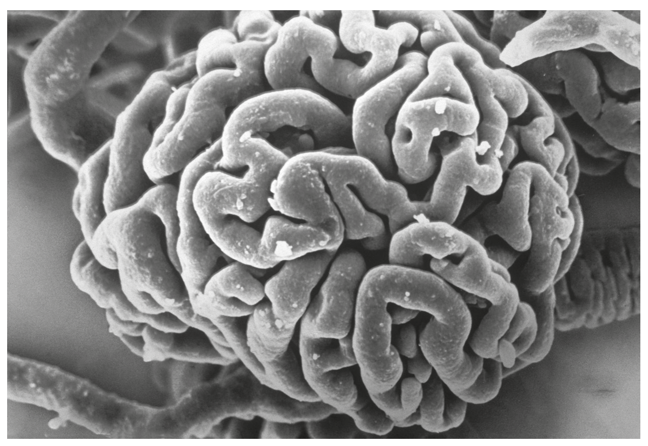 Fig. 3.1