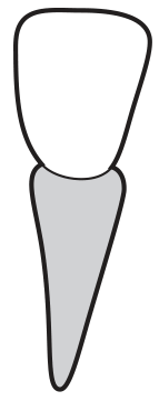 incisor