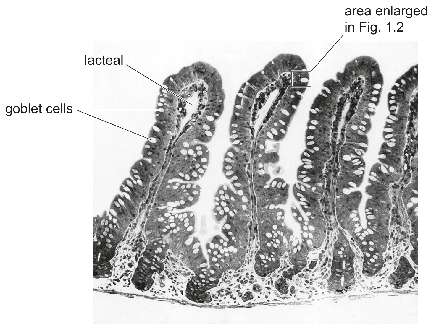Fig. 1.1