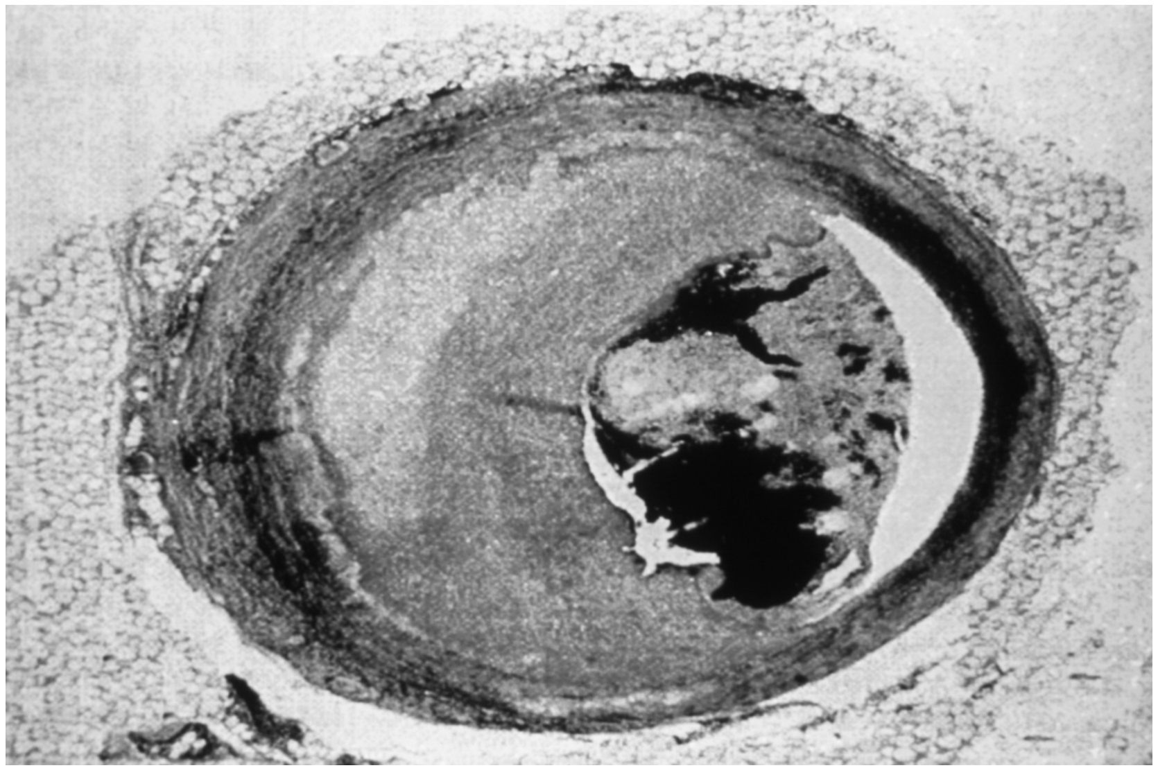 Fig. 2.1