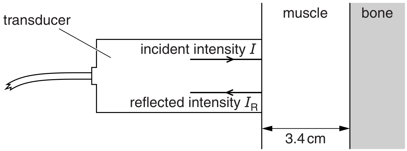 Fig. 11.1