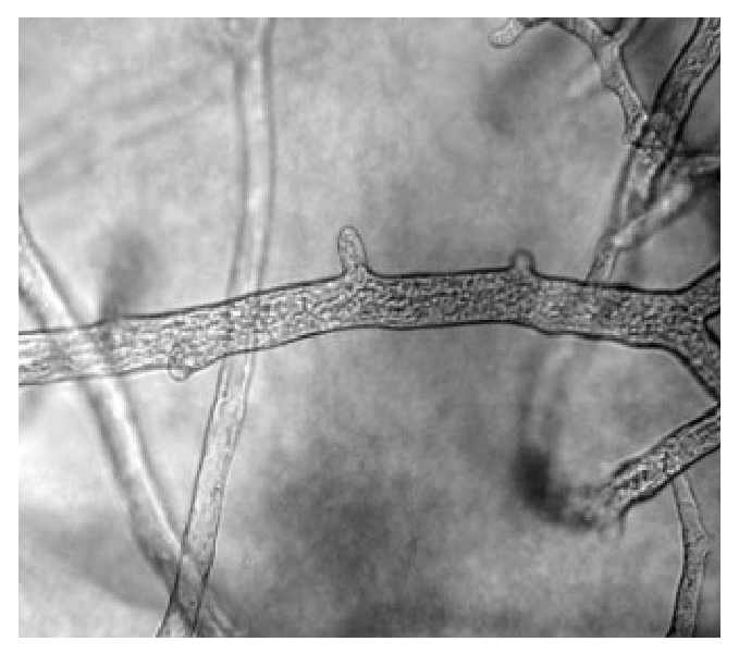 Aseptate fungal hyphae
