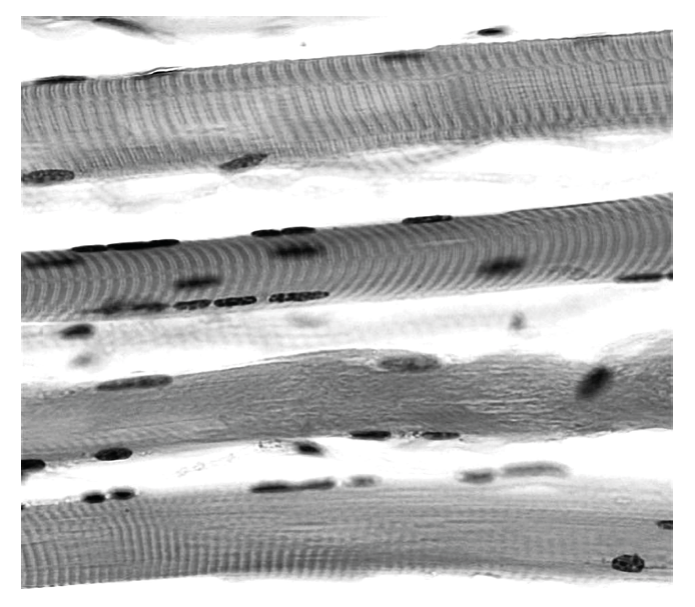 Striated muscle fibres